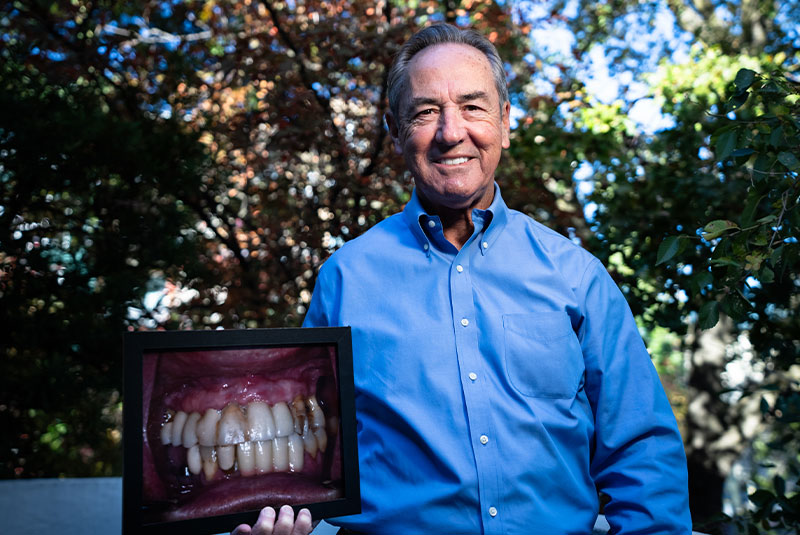 tony showing before after new dental implants