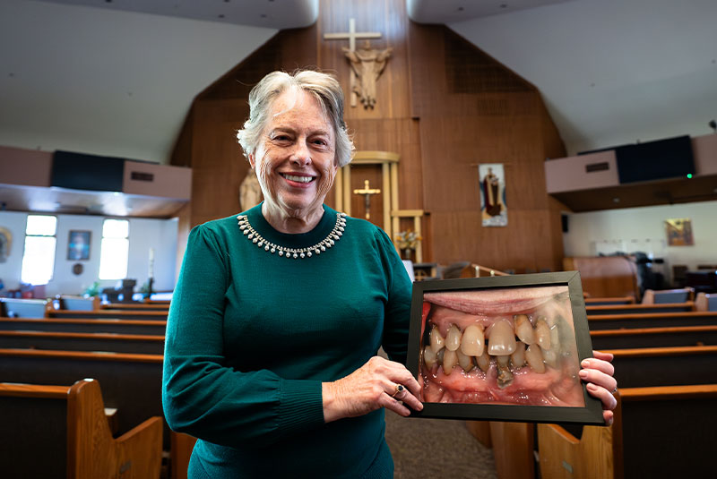 shirley showing before after with new dental implants