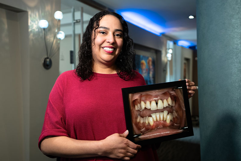 iris showing before after with dental implants