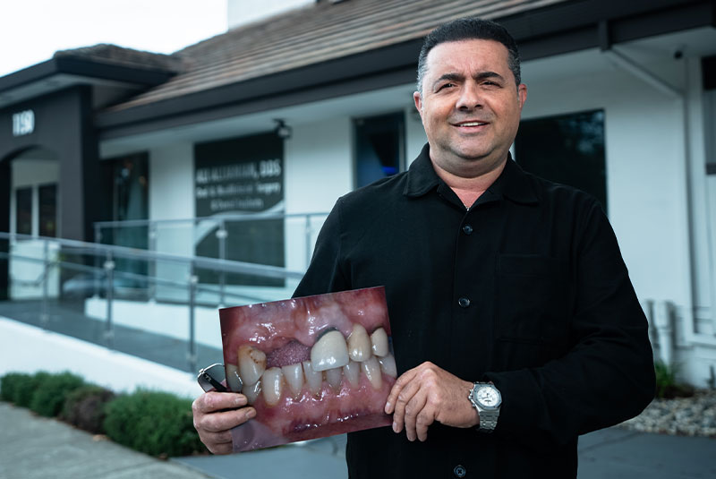 hamid showing before after after dental implant