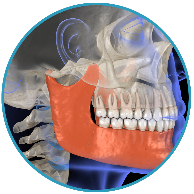 soft tissue impact